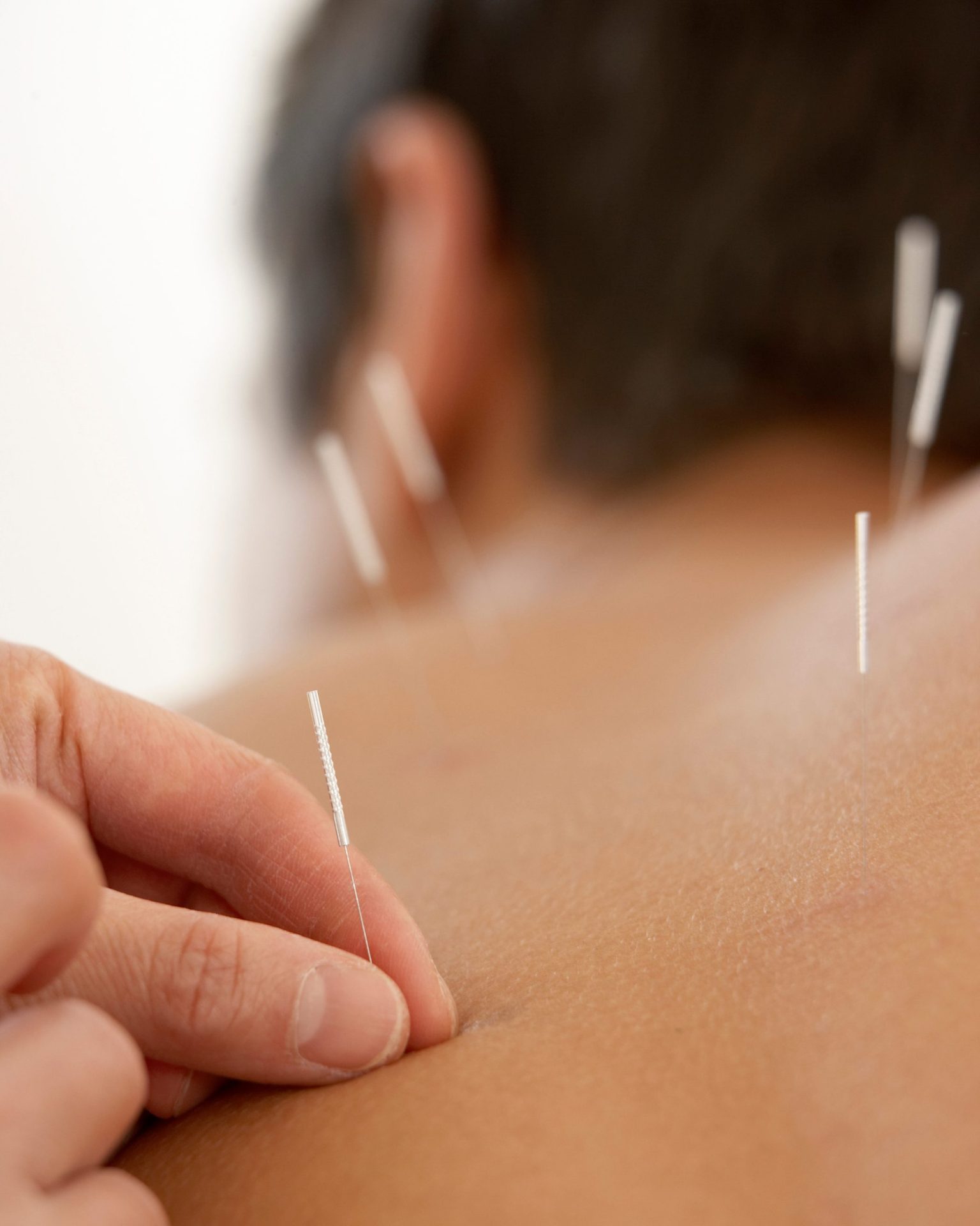 Community Acupuncture | Lancaster, PA | Hempfield Apothetique | Holistic Therapy